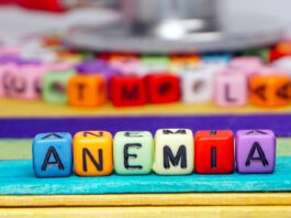 Anemia ferropriva da carenza di ferro