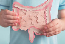 carcinoma colon-retto Vitamina D