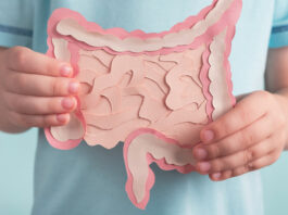 carcinoma colon-retto Vitamina D